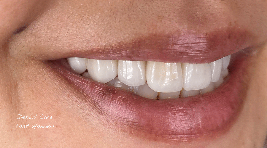 Smile Gallery Dental Care East Hanover