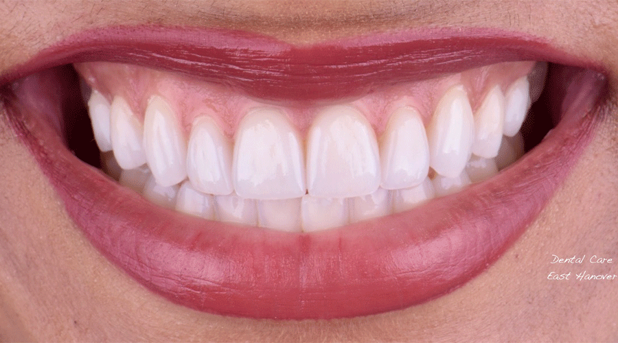 Smile Gallery Dental Care East Hanover