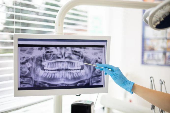 Digital Dental X-Rays in East Hanover, NJ, at Dental Care East Hanover